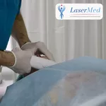 Tratament cu laser regenerarea pielii si eliminarea ridurilor in cabinetul de chirurgie laser “LaserMedChisinau” in Moldova!