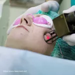 Лазерная шлифовка и удаление морщин лазером в Кишиневе!