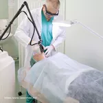 Eliminarea cu laser a pistruilor (Efilide) in Moldova!