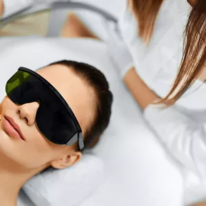 Tratament laser pentru pete pigmentare in Moldova