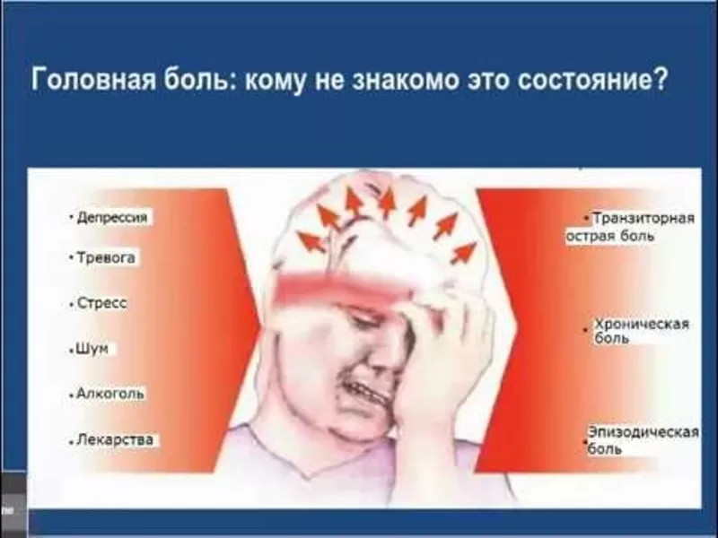 Болит голова во время поста. Головная боль. Стресс головная боль. Факторы головной боли. Острая головная боль.