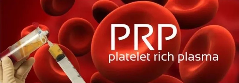 (  PRP,  platelet-rich plasma),   Плазмолифтинг в Кишиневе,  Молдове! В к