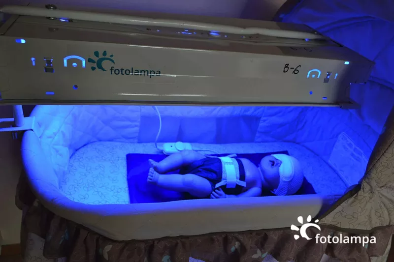  Лечение желтухи новорожденных на дому! АРЕНДА Лампы для фототерапии 3