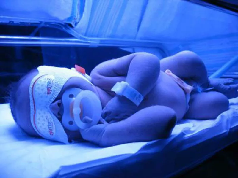 Лечение ДЕТСКОЙ желтухи новорожденных на дому ! АРЕНДА МЕДИЦИНСКОЙ Лампы для фототерапии от желтушки. 069495004 3