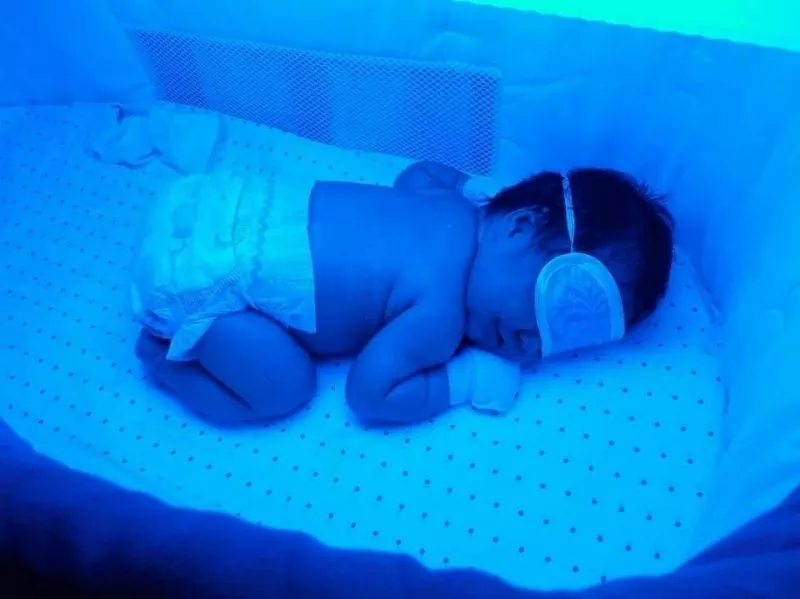 Лечение ДЕТСКОЙ желтухи новорожденных на дому ! АРЕНДА МЕДИЦИНСКОЙ Лампы для фототерапии от желтушки. 069495004 2