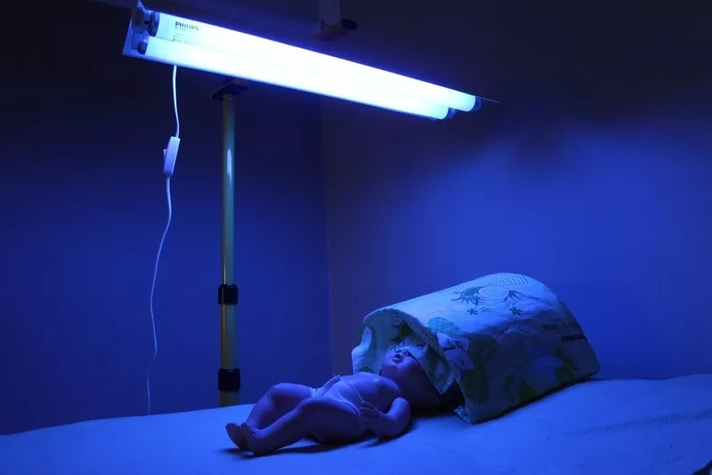  Аренда Лампы для фототерапии. Лечение желтухи на дому у малышей! 4