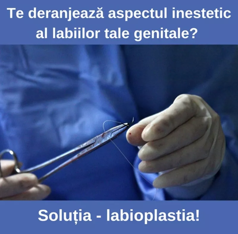 Labioplastie - chirurgie estetică