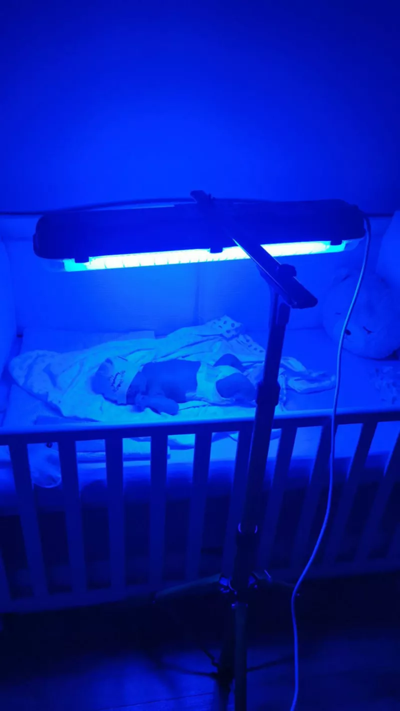 Лампа Philips лечение желтухи  у малышей(высокий Билирубин). Аренда.  7