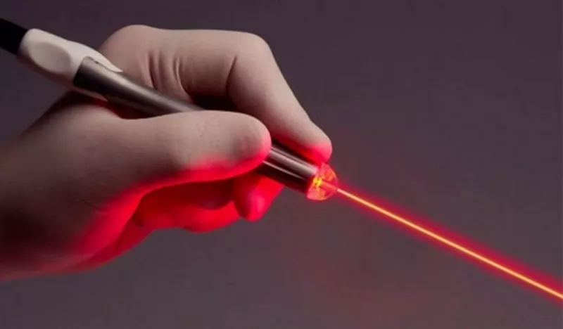   Лазерная френулопластика,  френулотомия в Кишиневе!