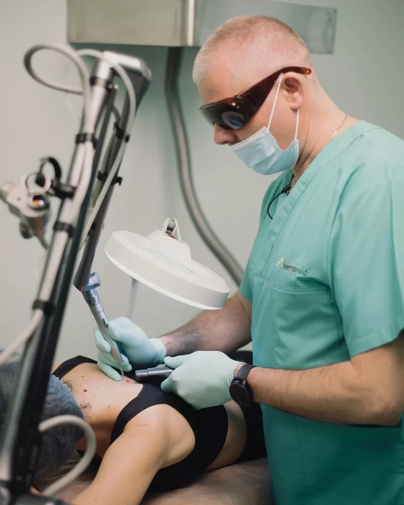 Indepărtarea (eliminarea,  inlaturarea) alunitelor (nevilor) cu laser 