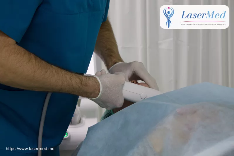 Tratament cu laser regenerarea pielii si eliminarea ridurilor in cabinetul de chirurgie laser “LaserMedChisinau” in Moldova!