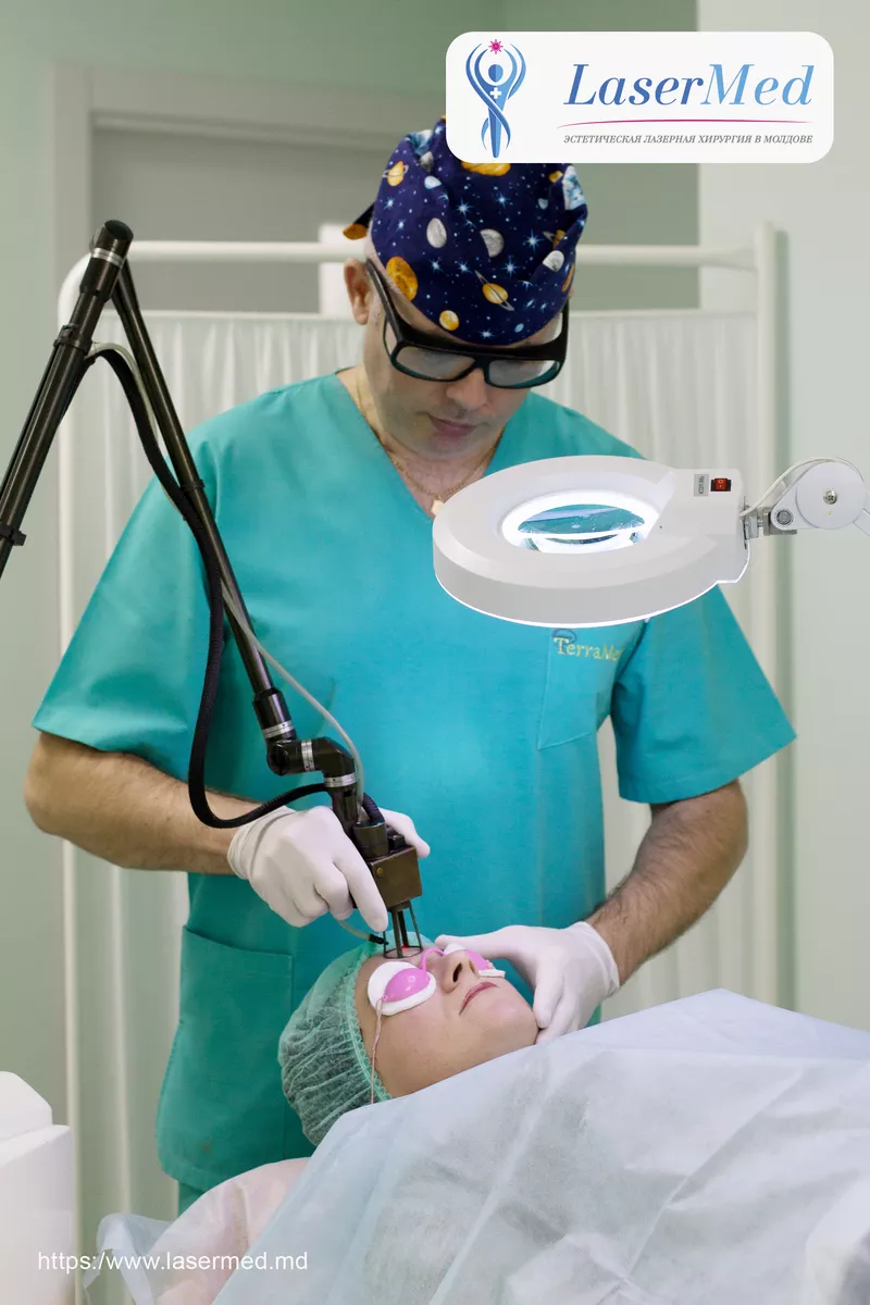 Tratament cu laser regenerarea pielii si eliminarea ridurilor in cabinetul de chirurgie laser “LaserMedChisinau” in Moldova! 5