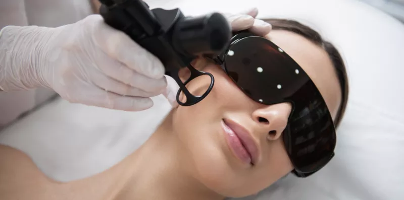 Eliminarea cu laser a pistruilor (Efilide) in Moldova! 4