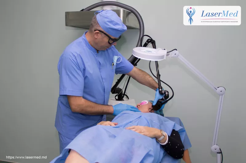 Remodelarea cutanata cu laser (peeling-ul cu laser, lasabraziune, resurfacing) in Moldova!