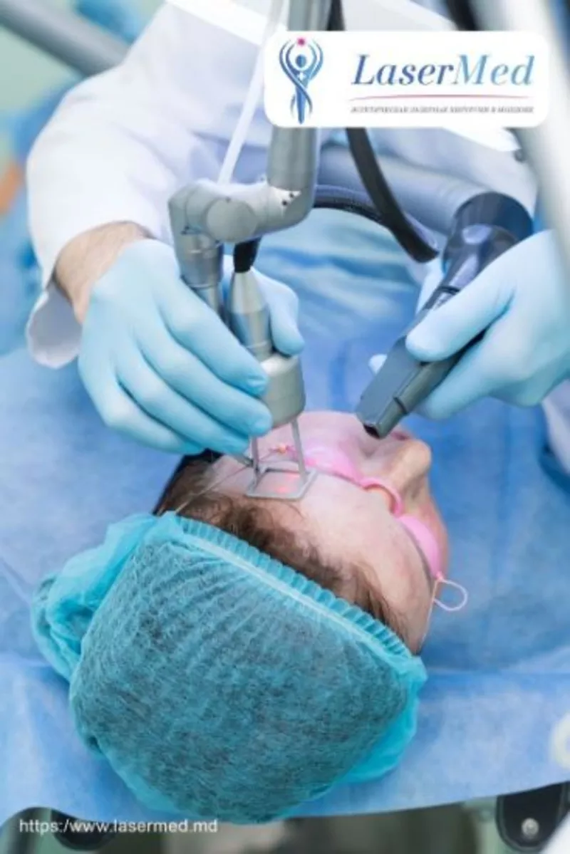Remodelarea cutanata cu laser (peeling-ul cu laser, lasabraziune, resurfacing) in Moldova! 2