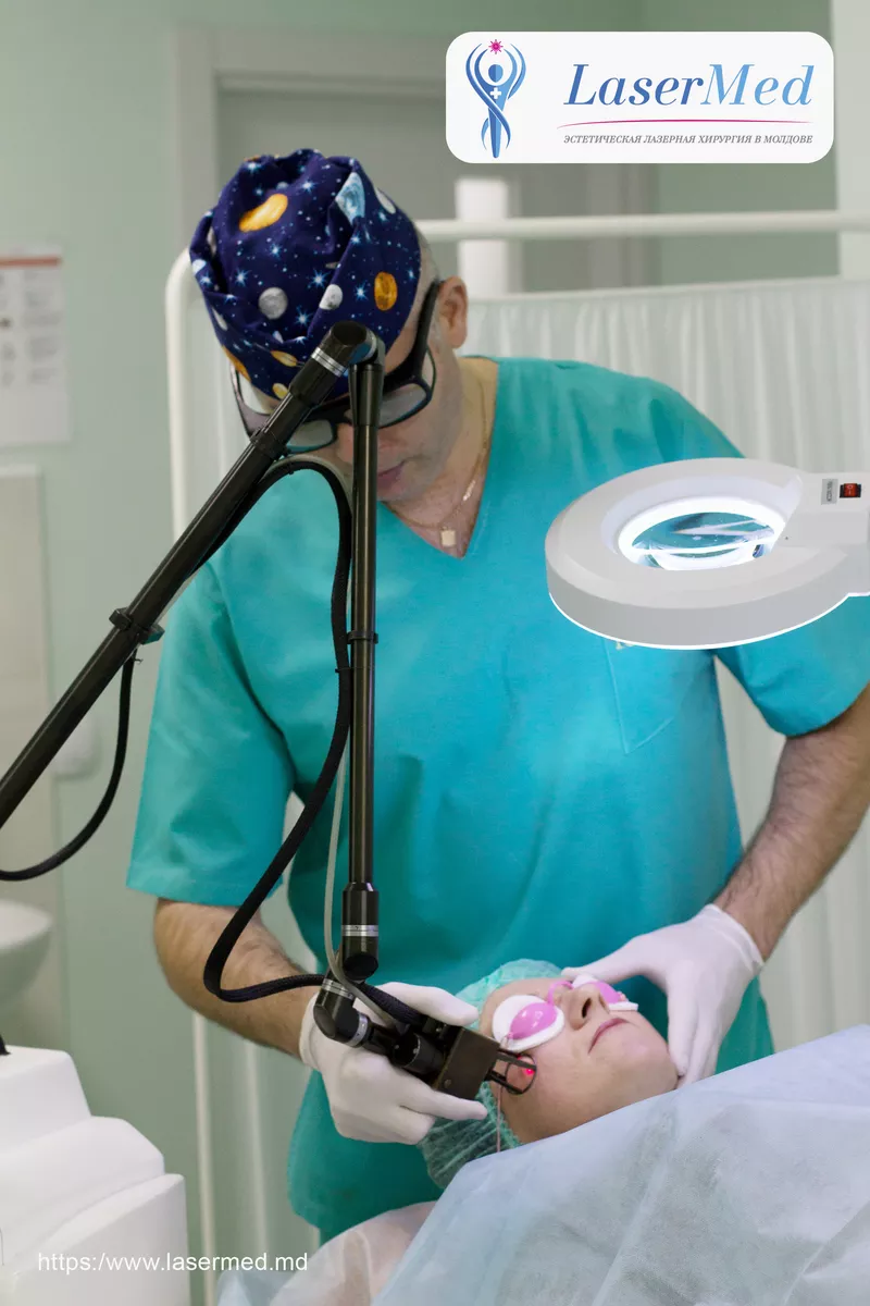  Tratamentele faciale cu laser CO2 fractional in combinatie cu terapia PRP in Moldova! 4