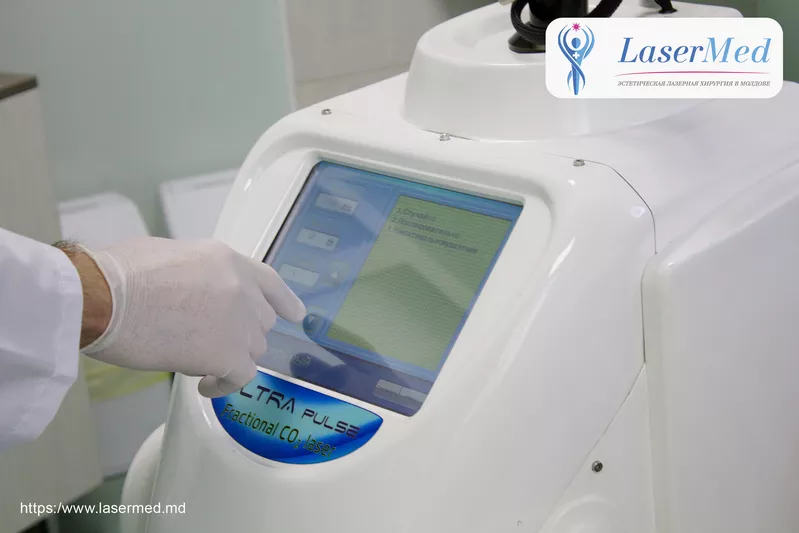  Tratamentele faciale cu laser CO2 fractional in combinatie cu terapia PRP in Moldova!