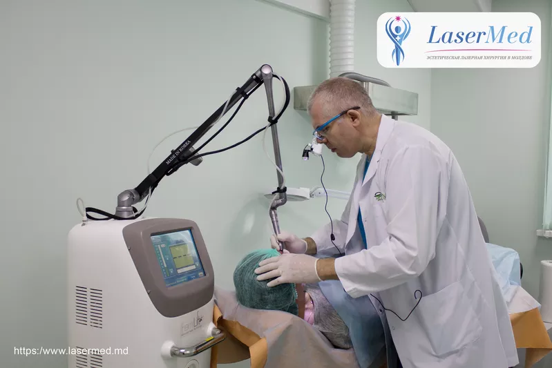 Tratamentul formatiunilor benigne cutanate cu laser in Moldova