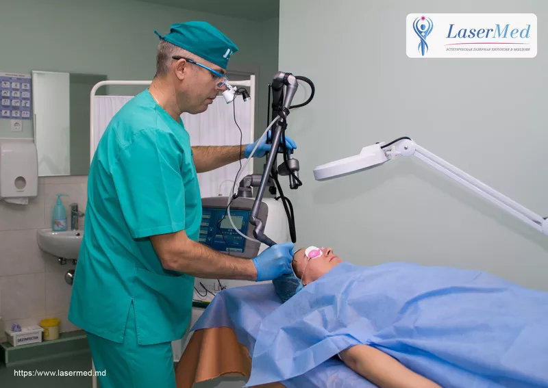 Tratamentul formatiunilor benigne cutanate cu laser in Moldova 3