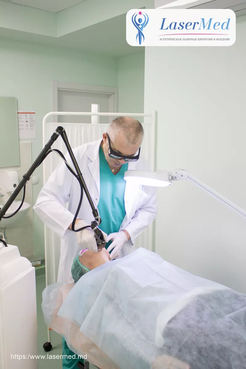 Tratamentul formatiunilor benigne cutanate cu laser in Moldova 2