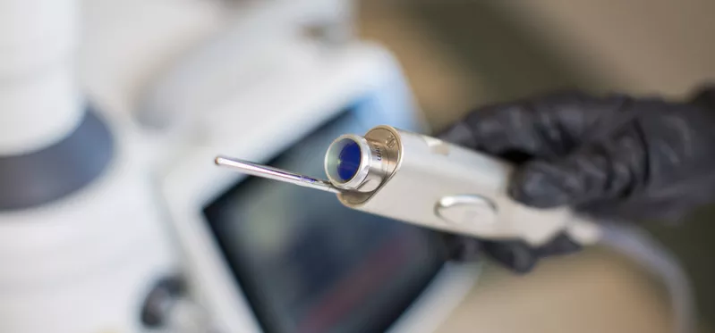 Лазерное удаление кондиломы и генитальных бородавок  в  (Кишинев) Молдове! 6