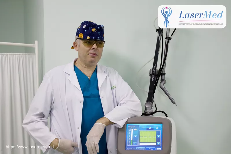 Лазерное удаление геморроя в Молдове, Кишиневе! 2