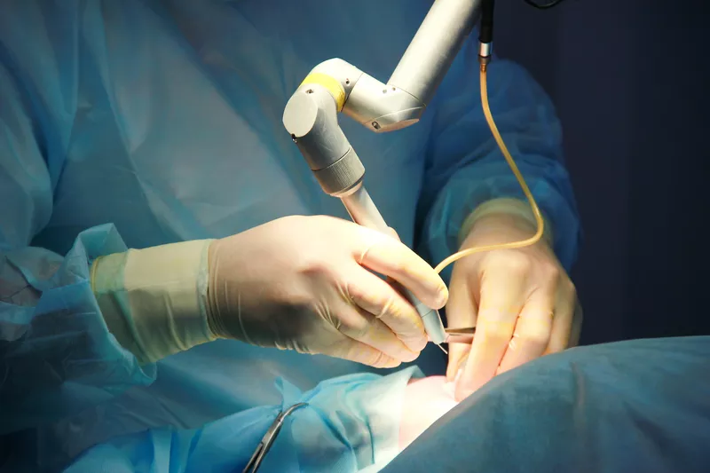  Лазерное удаление oстроконечных кондилом и генитальных бородавок в Кишиневе,  Молдове! 3