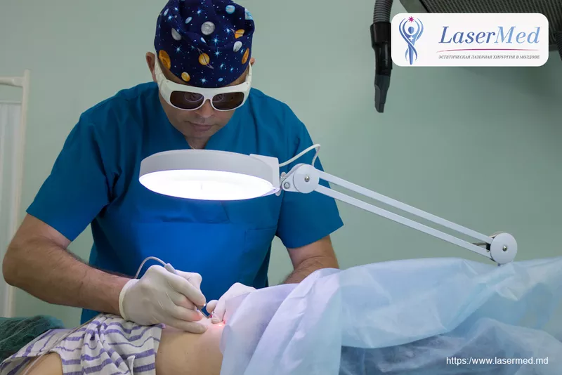  Лазерное удаление oстроконечных кондилом и генитальных бородавок в Кишиневе,  Молдове! 2