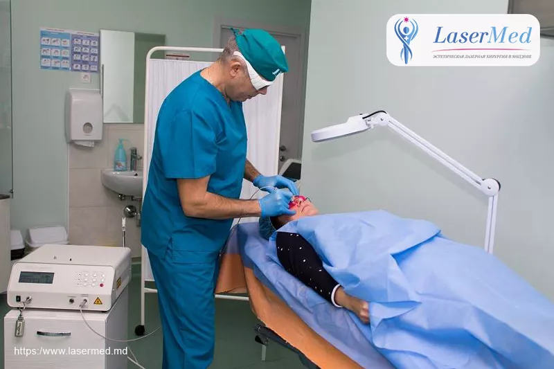 Tratamentul laser a leziunilor vasculare (telangiectazii,  capilare spa 5