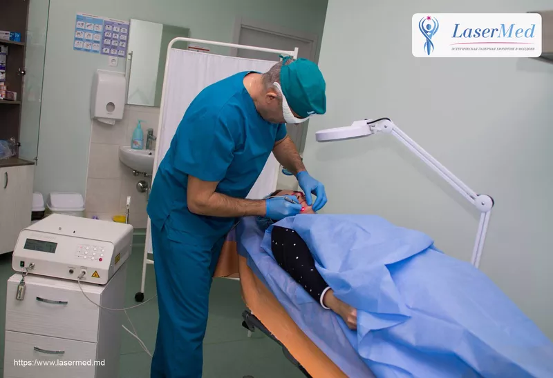 Tratamentul laser a leziunilor vasculare (telangiectazii,  capilare spa