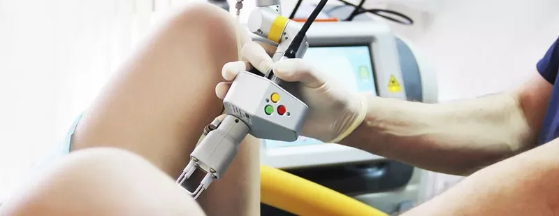 Chirurgie estetica intima: Laser plastia labiilor minore (labioplastia cu laser) in Chisinau,  Moldova! 2