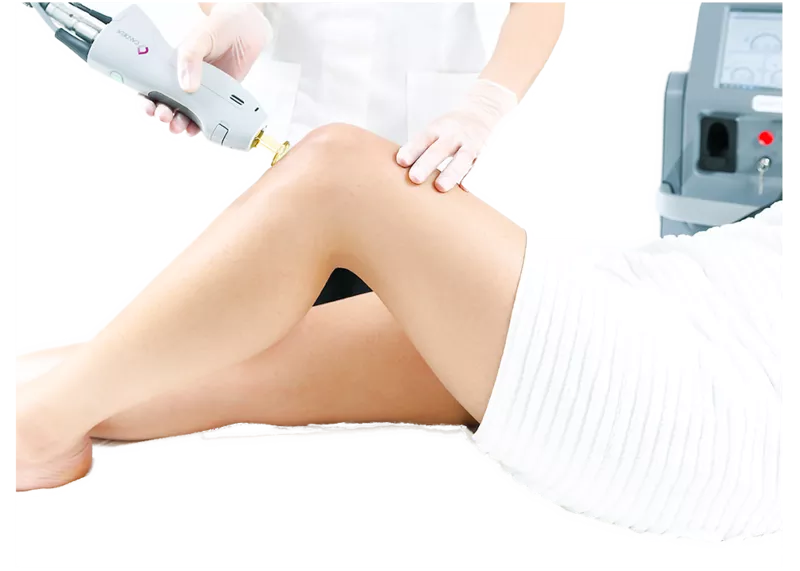 Интимная пластика: уменьшение малых половых губ (Лазерная Лабиопластика) в Кишиневе , Молдове! 4